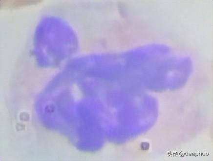 浅析细胞图像数据的主动学习