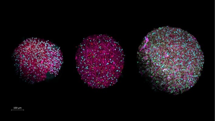 科学家提出“类器官智能”OI 概念：由人脑细胞驱动的生物计算机，比 AI 更智能