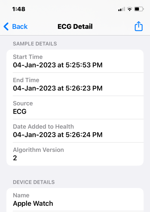 ecg-reading-on-iphone-9-a