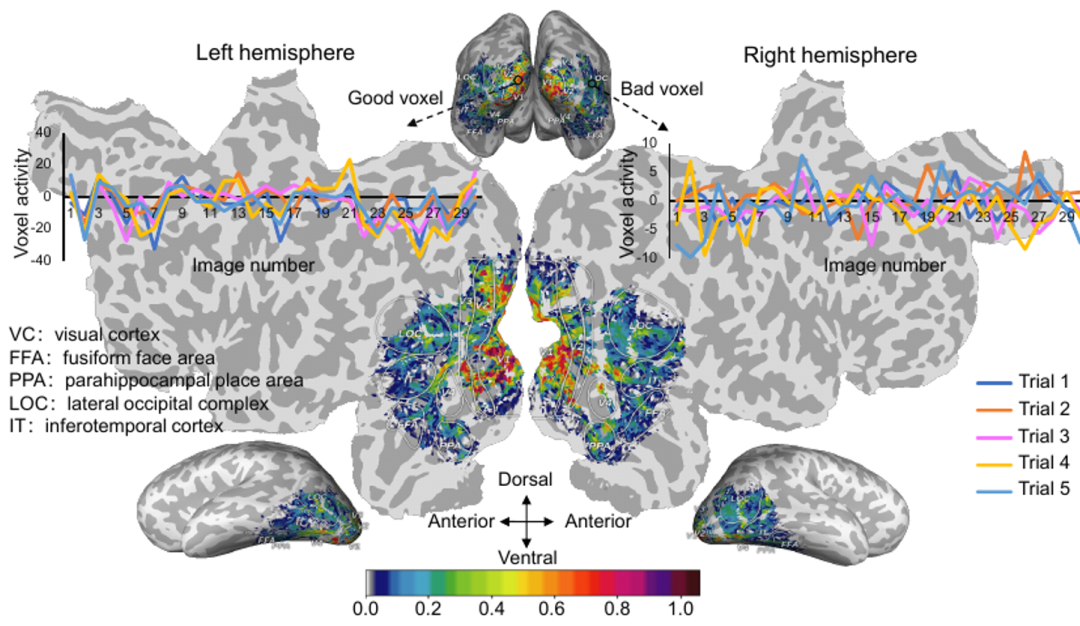 中科院自动化所研发多模态学习模型用于无创解码大脑信号语义