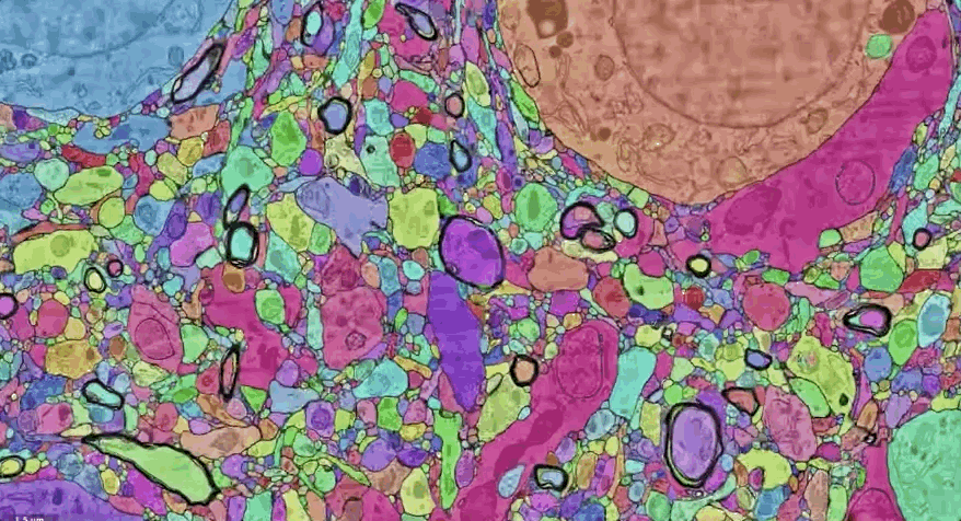 Science重磅封面：中国团队发布全球首个脑再生图谱！