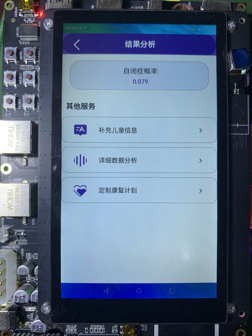 DAYU200运行自闭症早期筛查声纹特征滤波识别系统