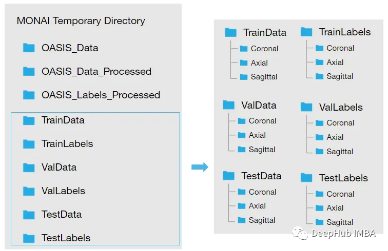 医学图像的深度学习的完整代码示例:使用Pytorch对MRI脑扫描的图像进行分割