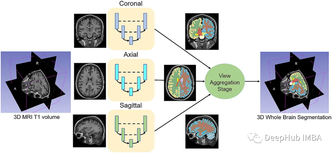 医学图像的深度学习的完整代码示例:使用Pytorch对MRI脑扫描的图像进行分割