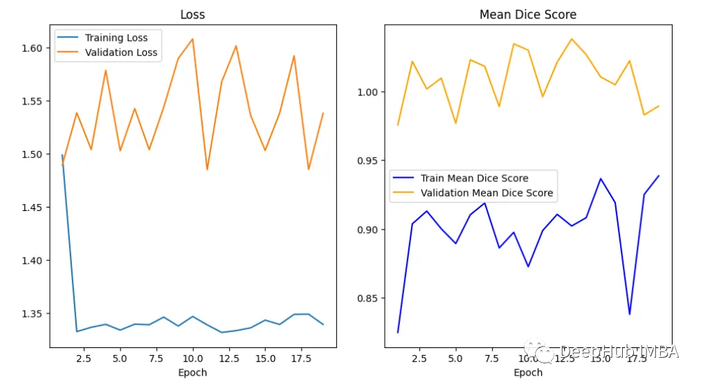 医学图像的深度学习的完整代码示例:使用Pytorch对MRI脑扫描的图像进行分割