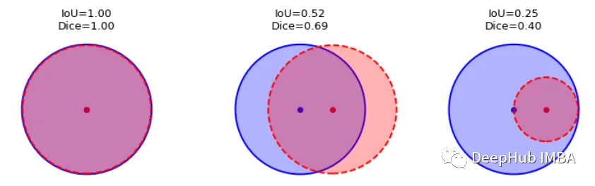 医学图像的深度学习的完整代码示例:使用Pytorch对MRI脑扫描的图像进行分割