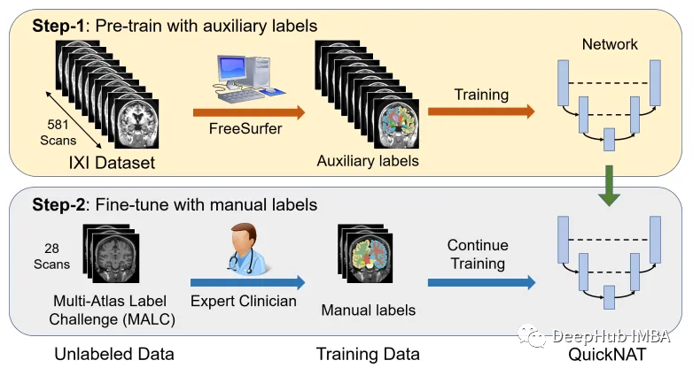 医学图像的深度学习的完整代码示例：使用Pytorch对MRI脑扫描的图像进行分割
