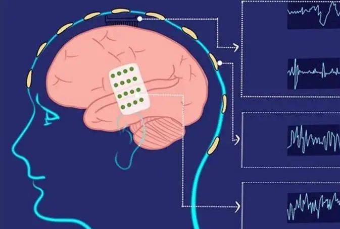 又一颠覆性技术火了！脑机接口技术未来将在这些领域率先取得突破