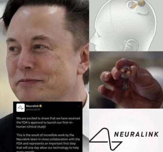 “脑机接口”市场爆发有望超千亿！微美全息多项专利迎来重大技术进展