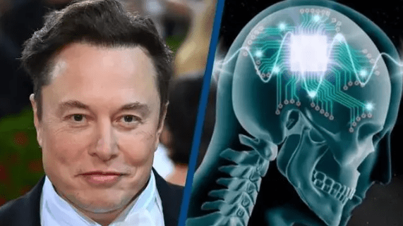 马斯克脑机接口将兑现 首例人体植入试验2023年启动