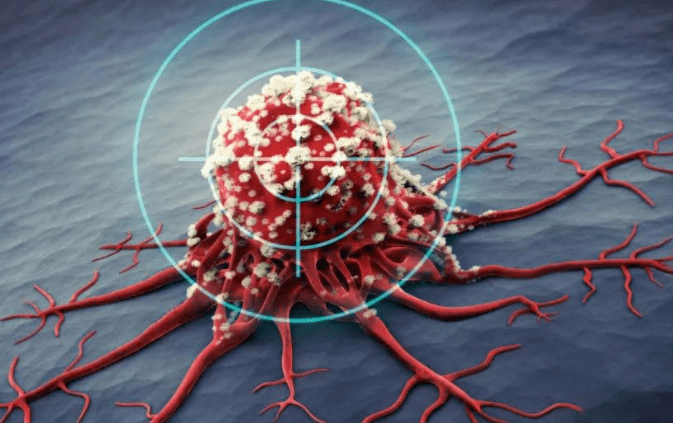 RFID标签可用于乳腺癌治疗，你敢信？-IOTE物联网展