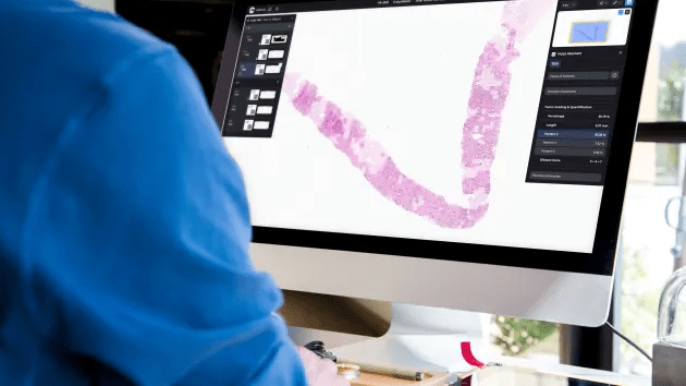 微软与Paige合作，共建全球最大的基于图像的人工智能模型