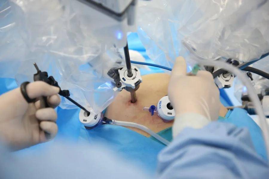 借助机器人精准“操刀”！守护前列腺癌患者健康