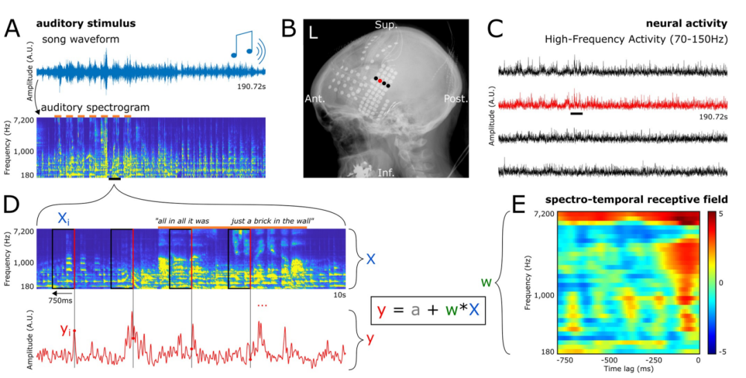UC伯克利脑机接口突破:利用脑电波重现音乐,为语言障碍者带来福音!