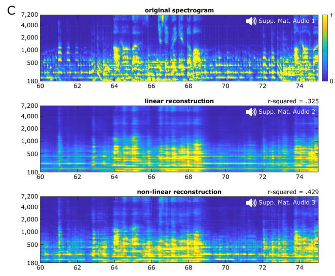 UC伯克利脑机接口突破:利用脑电波重现音乐,为语言障碍者带来福音!