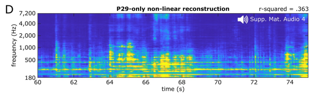 UC伯克利脑机接口突破:利用脑电波重现音乐,为语言障碍者带来福音!