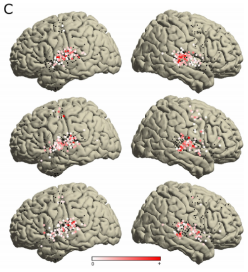 UC伯克利脑机接口突破:利用脑电波重现音乐,为语言障碍者带来福音!