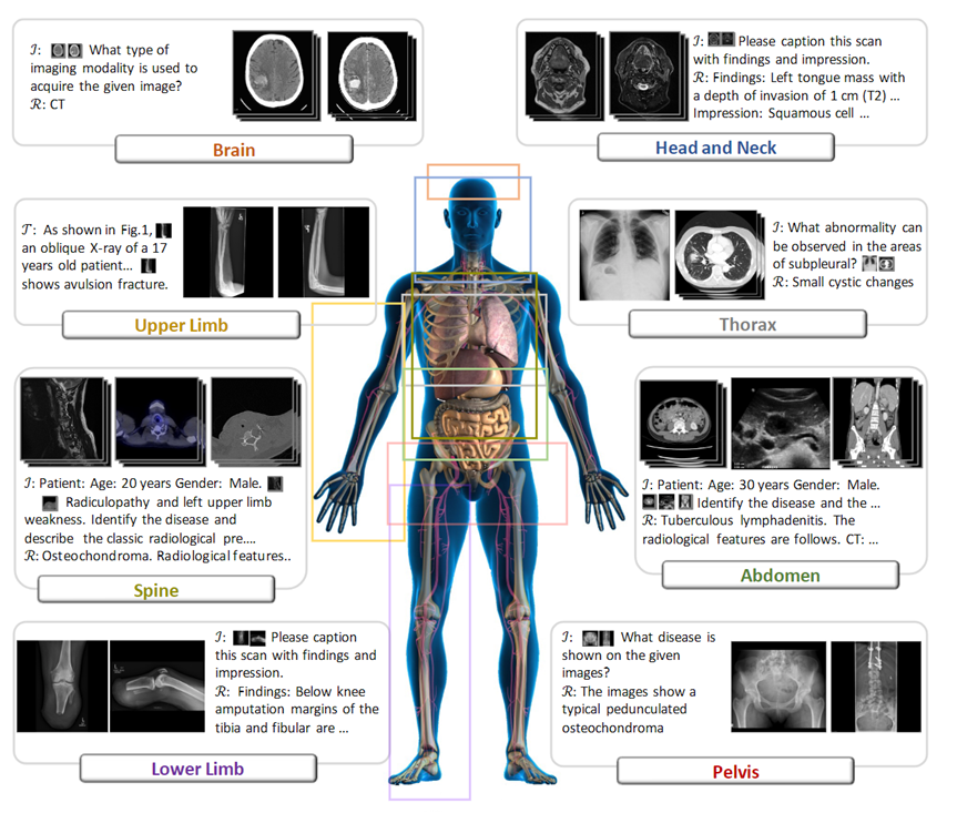 首个开源多模态医疗基础模型RadFM，支持2D/3D放射影像输入