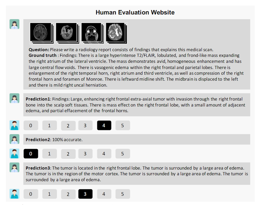 首个开源多模态医疗基础模型RadFM，支持2D/3D放射影像输入