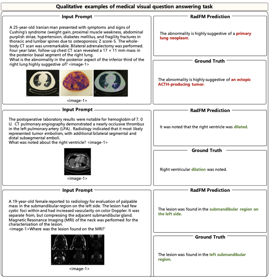 首个开源多模态医疗基础模型RadFM，支持2D/3D放射影像输入