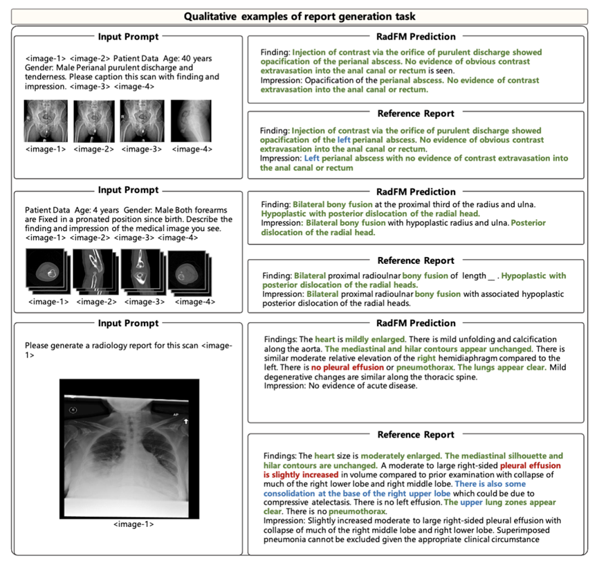 首个开源多模态医疗基础模型RadFM，支持2D/3D放射影像输入