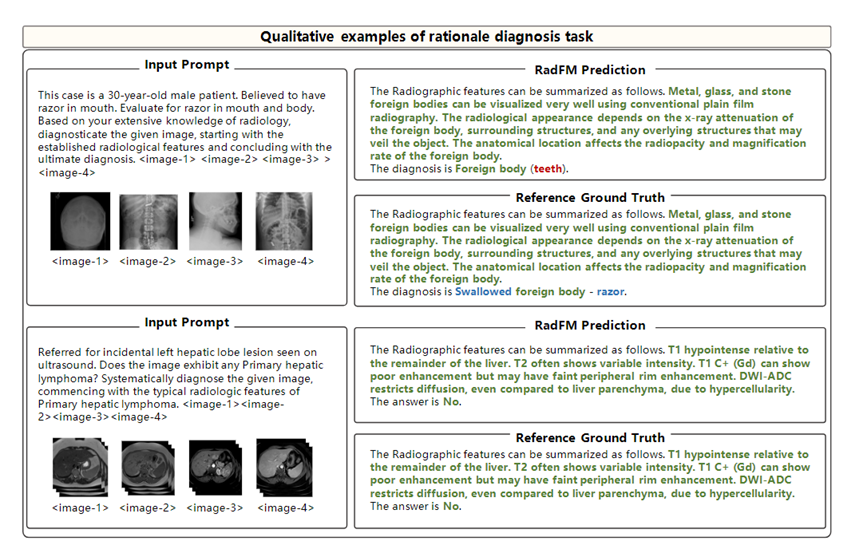 首个开源多模态医疗基础模型RadFM，支持2D/3D放射影像输入