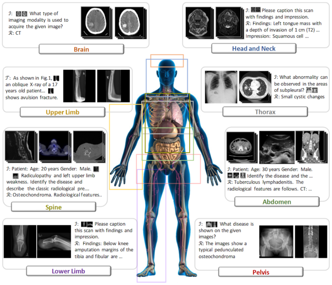 全球首个开源多模态医疗基础模型:人工打分平均超越GPT-4V、支持2D/3D放射影像