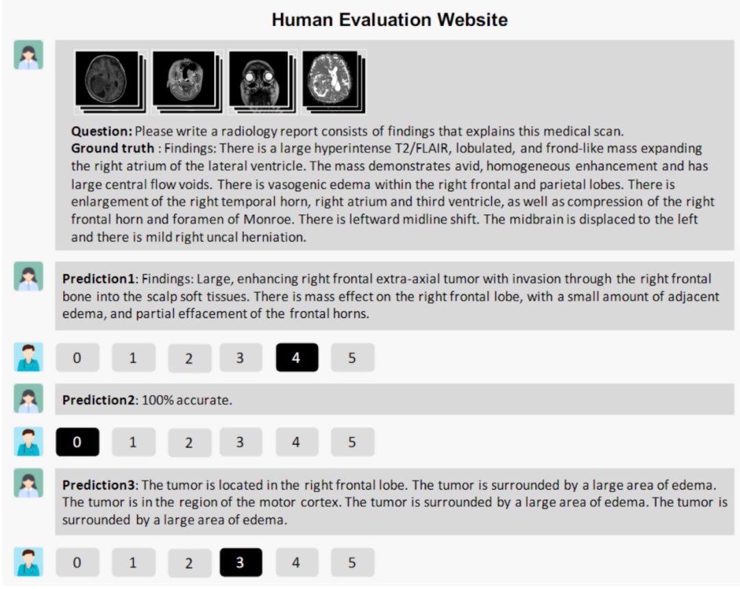 全球首个开源多模态医疗基础模型:人工打分平均超越GPT-4V、支持2D/3D放射影像