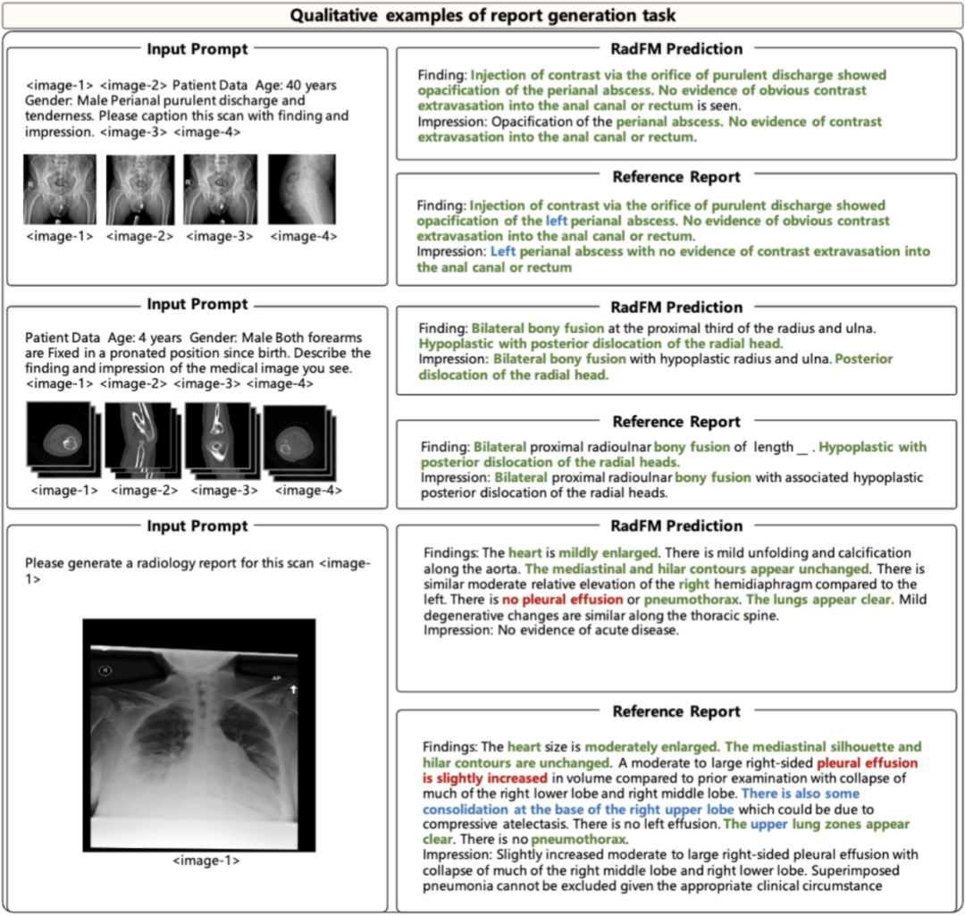 全球首个开源多模态医疗基础模型:人工打分平均超越GPT-4V、支持2D/3D放射影像