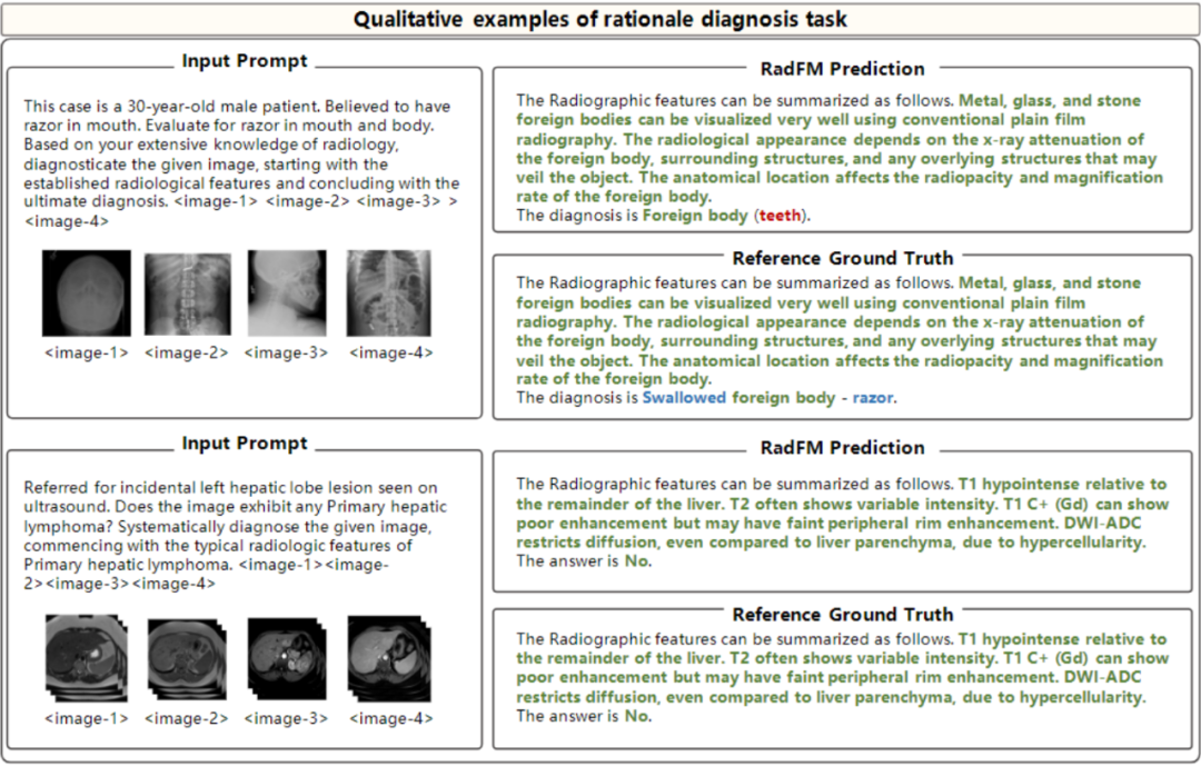 全球首个开源多模态医疗基础模型:人工打分平均超越GPT-4V、支持2D/3D放射影像