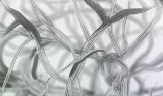 比马斯克脑机接口更精确微创,超声波读脑大法来了