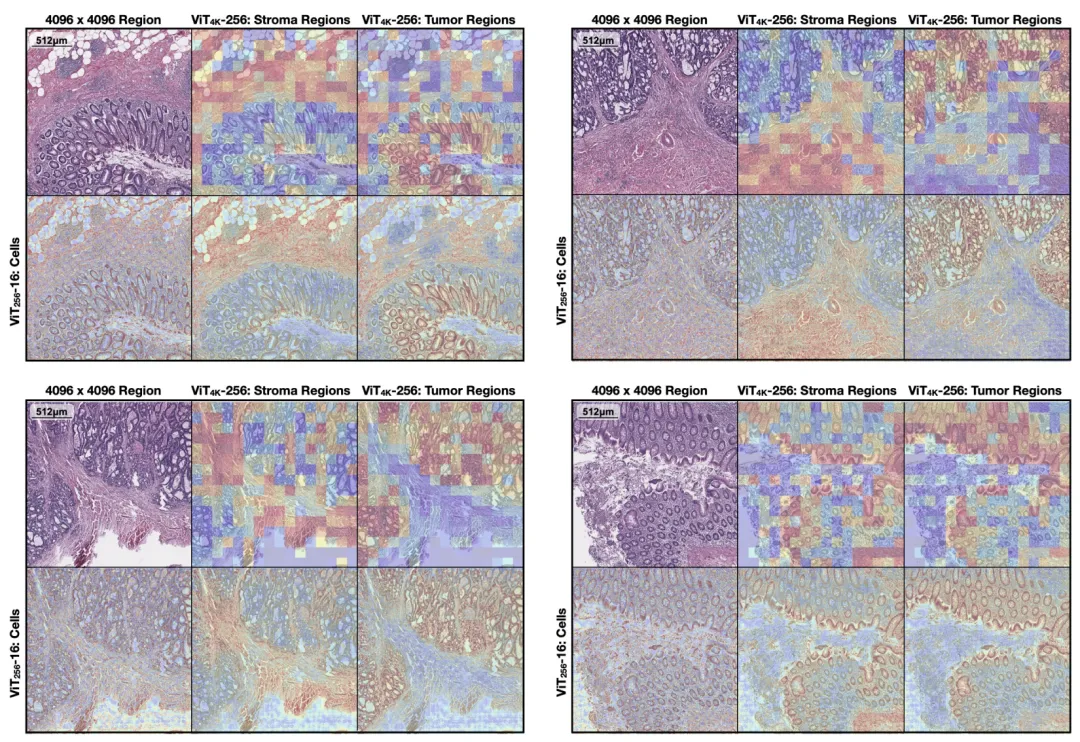 基于分层自监督学习将视觉Transformer扩展到千兆像素图像
