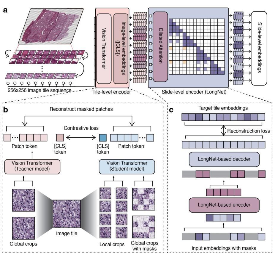 Nature重磅：微软潘海峰华盛顿大学王晟团队发布首个全切片数字病理学模型GigaPath