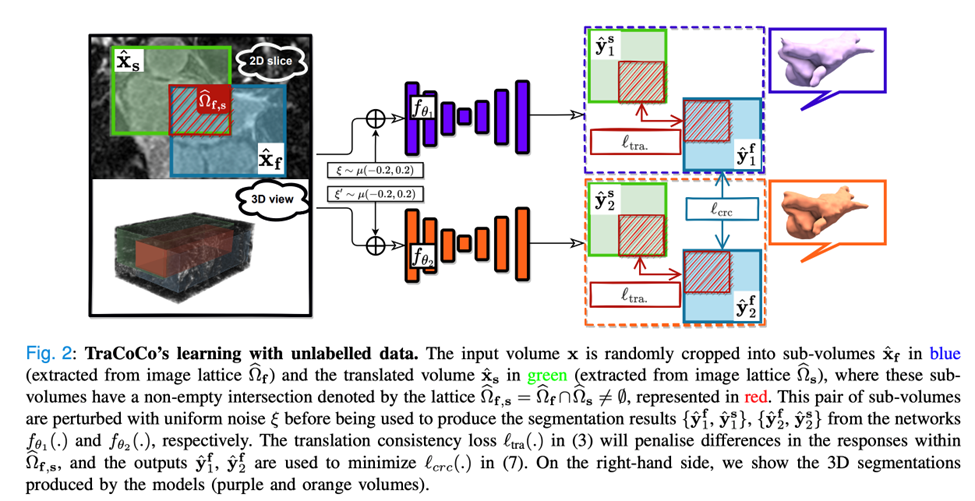 TMI2024 | 阿大、同济等提出TraCoCo，用于3D医学图像半监督分割