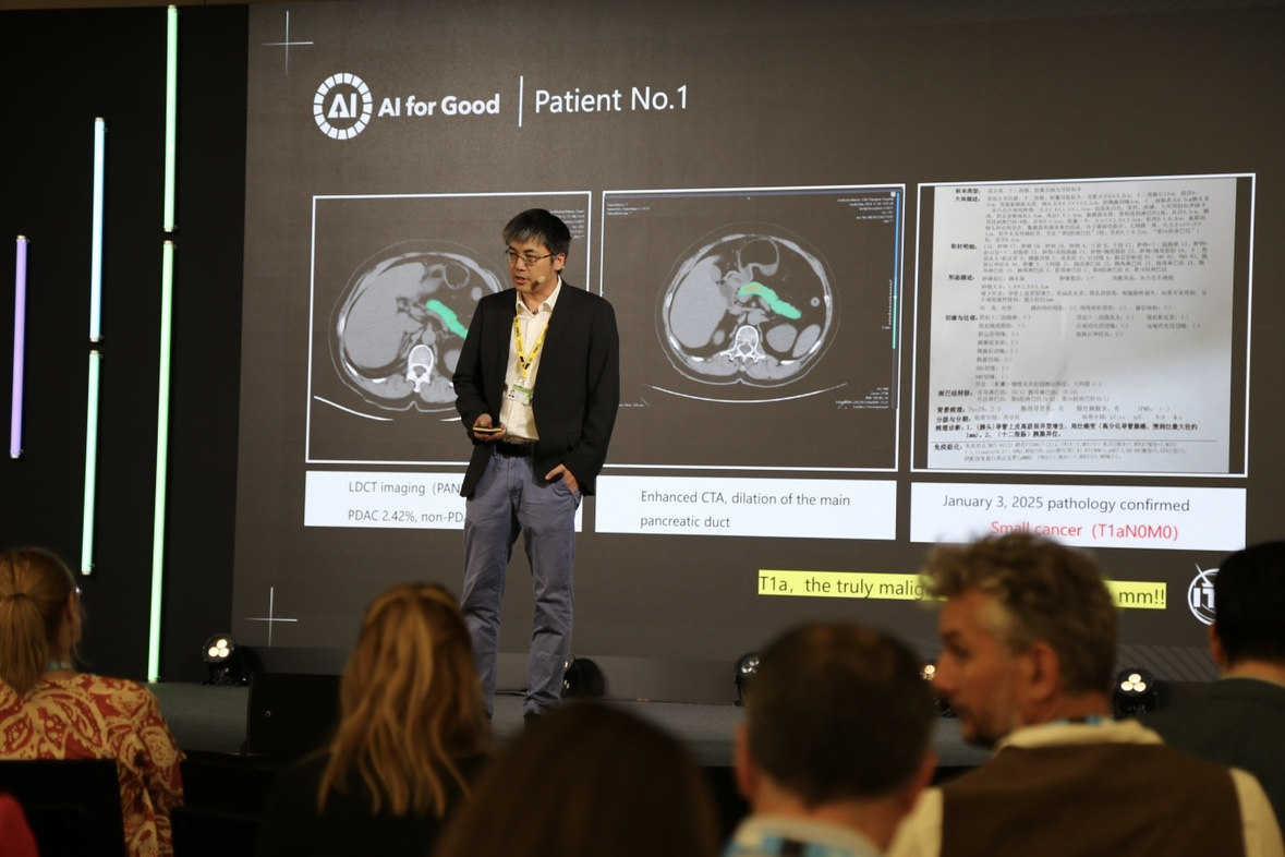 阿里达摩院再登联合国AI峰会,多癌早筛AI已服务9个国家地区2000万人次