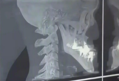 男子因拥有“世界上最长的下巴”走红 拍视频月入6位数