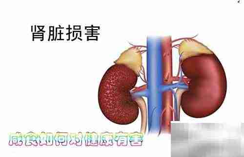 咸食过量危害健康