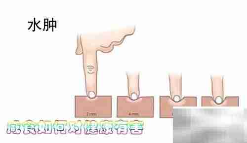 咸食过量危害健康