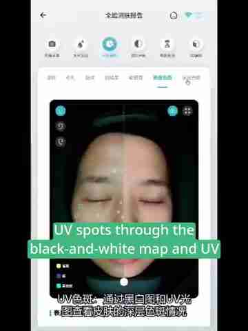 皮肤检测报告解读:深层分析与护理建议