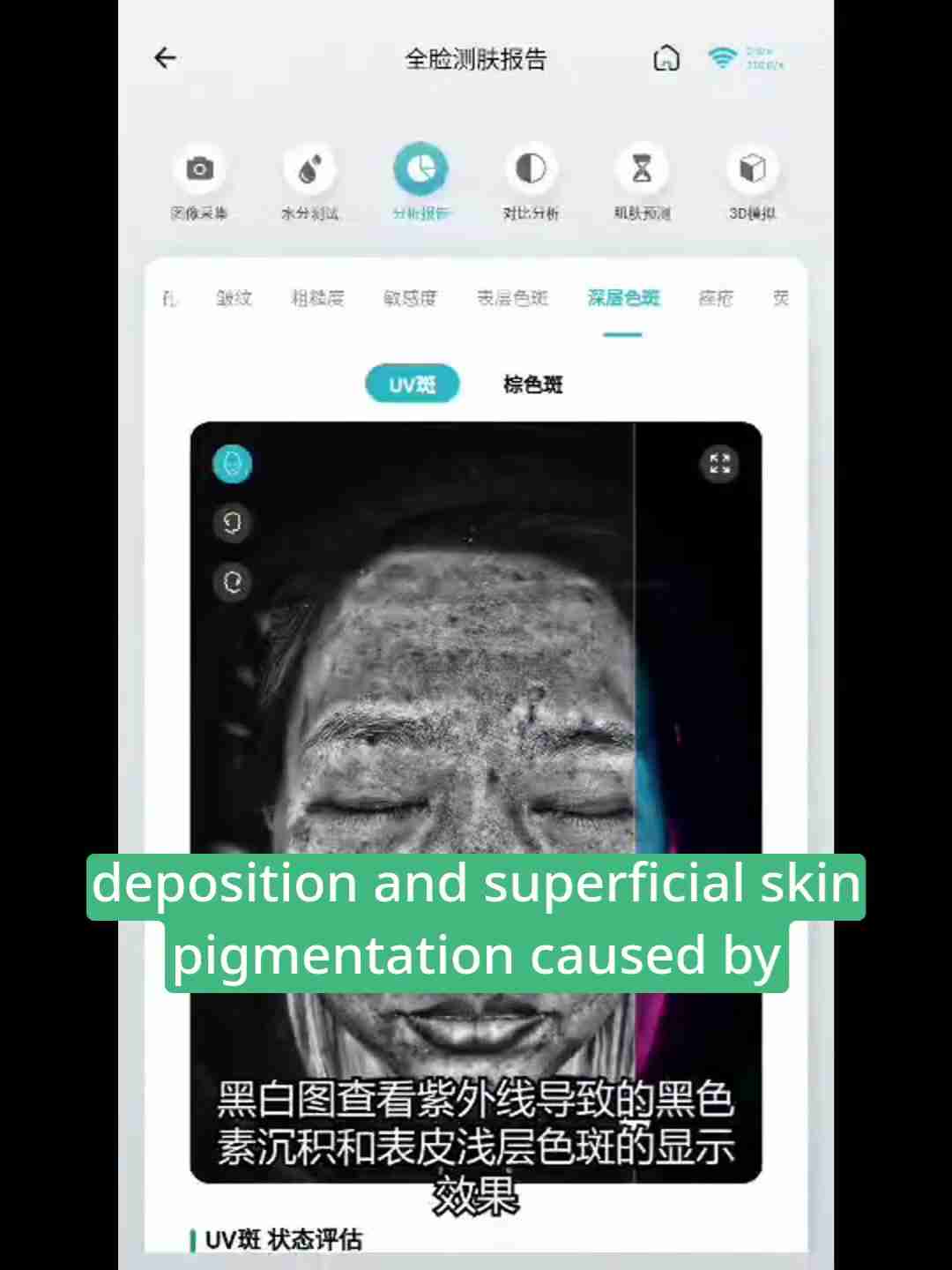 皮肤检测报告解读:深层分析与护理建议