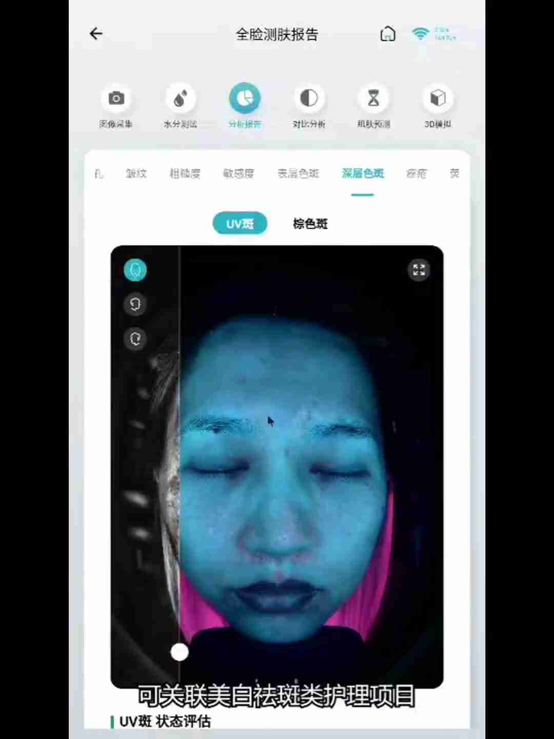 皮肤检测报告解读:深层分析与护理建议