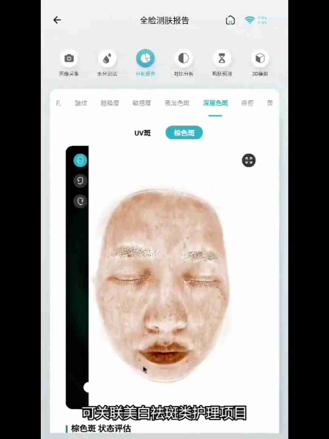 皮肤检测报告解读:深层分析与护理建议
