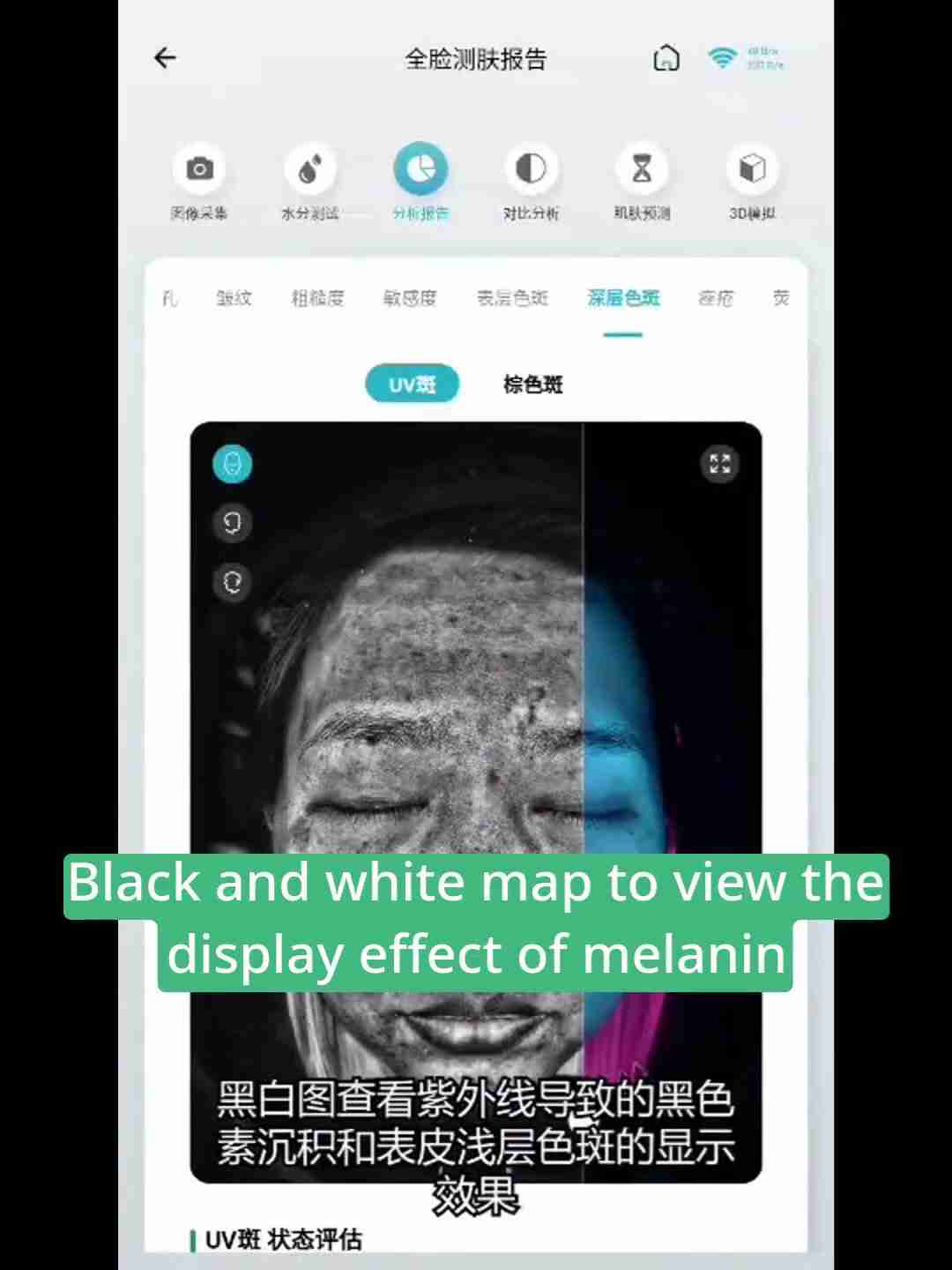 皮肤检测报告解读:深层分析与护理建议