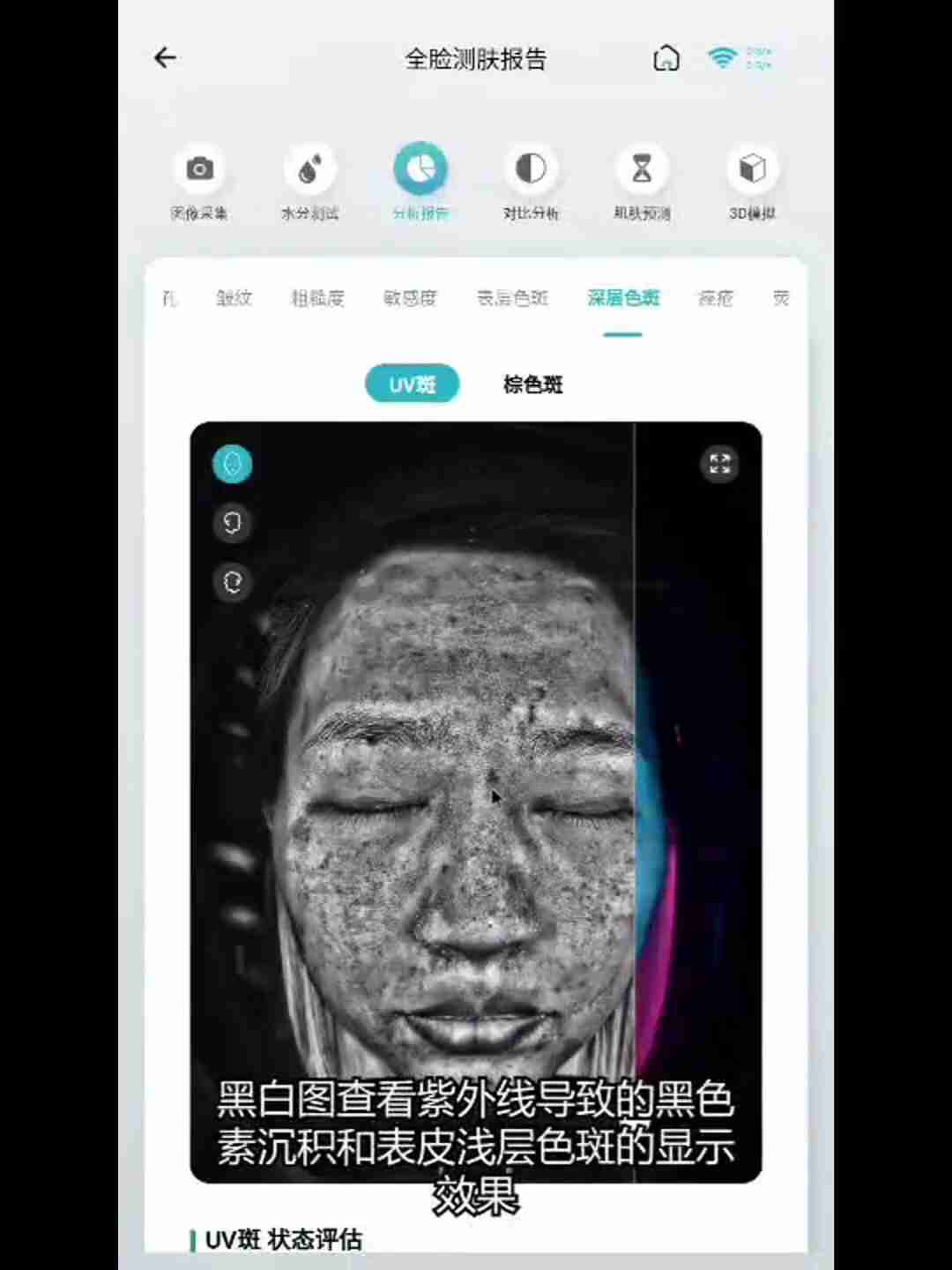 皮肤检测报告解读:深层分析与护理建议
