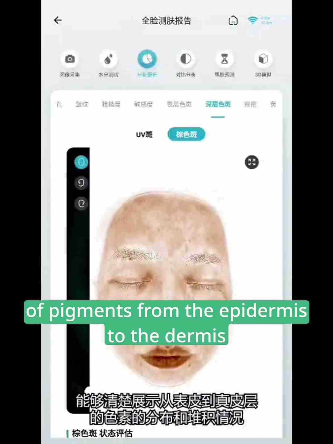 皮肤检测报告解读:深层分析与护理建议