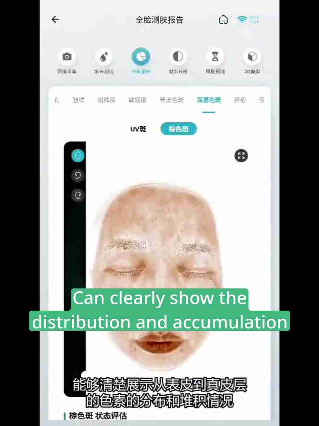 皮肤检测报告解读:深层分析与护理建议