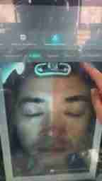 智能皮肤检测仪：开箱、安装及使用指南