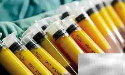 自体脂肪填充致脸歪？