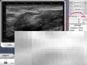 Ultra Skin系统使用指南