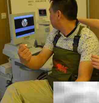 胶囊胃镜的优势解析